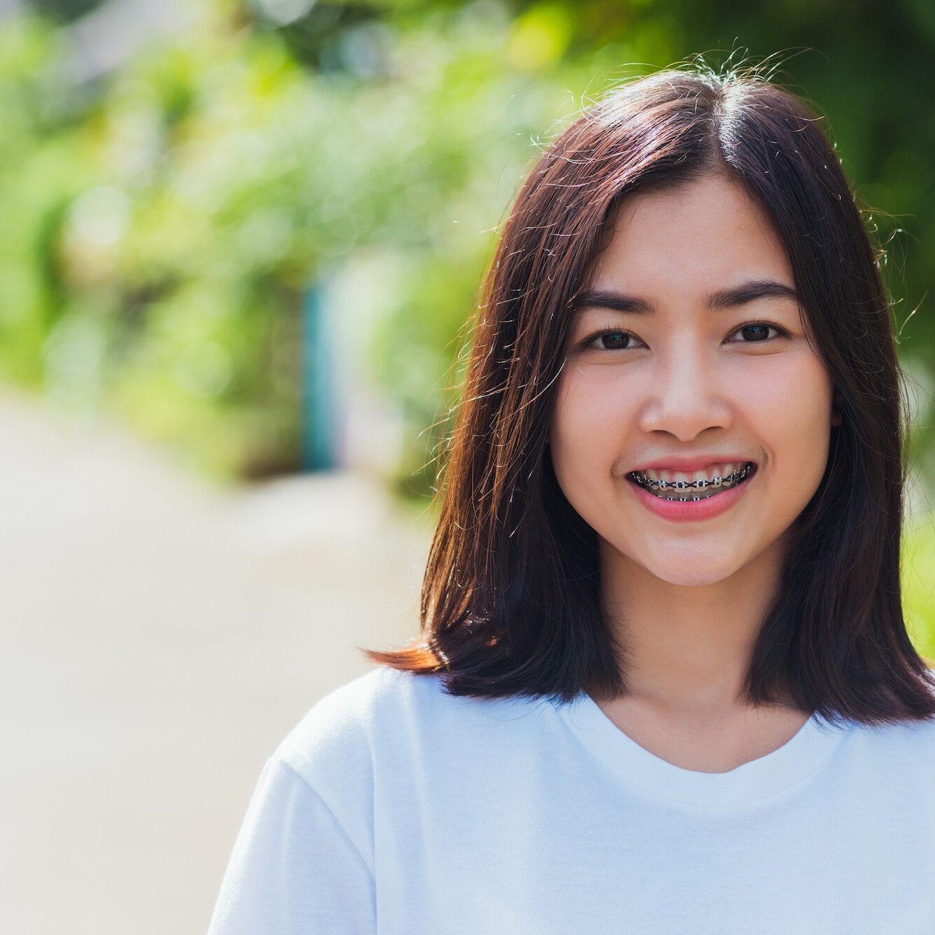 Portrait of Asian teen beautiful young woman smile have dental braces on teeth laughing outdoor, Medicine and dentistry concept